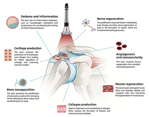 clinical applications SuperMax Class IV Laser